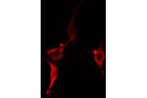 ABIN6274925 staining RAW264. (BAIAP2L2 antibody  (Internal Region))