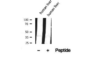 Western blot analysis of extracts of human liver tissue, using COQ9 antibody.