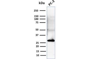 Western Blot Analysis of Human PC-3 cell lysate using Stratifin Mouse Monoclonal Antibody (CPTC-SFN-2).