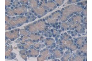 Detection of 15-LO-2 in Rat Pancreas Tissue using Polyclonal Antibody to 15-Lipoxygenase-2 (15-LO-2) (ALOX15B antibody  (AA 349-633))
