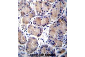 CES8 Antibody (C-term) immunohistochemistry analysis in formalin fixed and paraffin embedded human stomach tissue followed by peroxidase conjugation of the secondary antibody and DAB staining. (CES4A antibody  (C-Term))