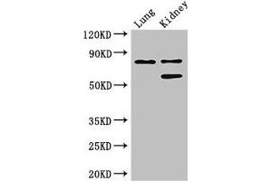 Western Blot Positive WB detected in: Mouse lung tissue, Mouse kidney tissue All lanes: LEPREL1 antibody at 3 μg/mL Secondary Goat polyclonal to rabbit IgG at 1/50000 dilution Predicted band size: 81, 61 kDa Observed band size: 81, 61 kDa