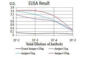 Black line: Control Antigen (100 ng),Purple line: Antigen (10 ng), Blue line: Antigen (50 ng), Red line:Antigen (100 ng) (RIPK4 antibody  (AA 675-784))