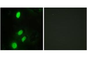 Immunofluorescence analysis of HeLa cells, using ETV6 Antibody. (ETV6 antibody  (AA 371-420))
