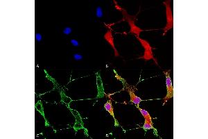 Immunocytochemistry/Immunofluorescence analysis using Mouse Anti-SHANK1 Monoclonal Antibody, Clone S22-21 (ABIN863122). (SHANK1 antibody  (AA 469-691))