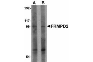 Image no. 1 for anti-FERM and PDZ Domain Containing 2 (FRMPD2) (N-Term) antibody (ABIN478186) (FRMPD2 antibody  (N-Term))