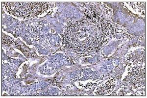 IHC analysis of NDEL1 using anti-NDEL1 antibody (ABIN7602511).