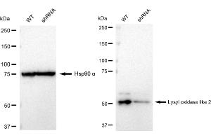 Western blotting analysis using Lysyl oxidase like 2 antibody (ABIN7799312). (Recombinant LOXL2 antibody)