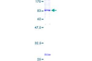 LGI1 Protein (AA 1-557) (GST tag)