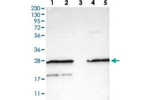 Western Blot analysis of (1) Human RT-4 cell, (2) Human U-251MG cell, (3) Human plasma (IgG/HSA depleted), (4) Human liver tissue, (5) Human tonsil tissue. (FNTA antibody)