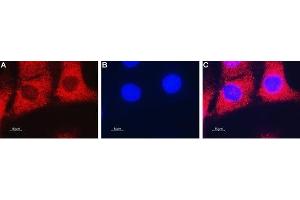Expression of ENT2 in mouse C2C12 myoblast cells - Immunocytochemical staining of fixed and permeabilized mouse C2C12 myoblast cells. (SLC29A2 antibody  (3rd Intracellular Loop))