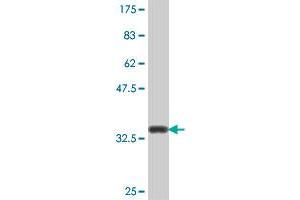 Western Blotting (WB) image for anti-Eukaryotic Translation Initiation Factor 2B, Subunit 5 Epsilon, 82kDa (EIF2B5) (AA 622-720) antibody (ABIN563871)