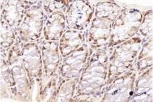 Immunohistochemistry analysis of paraffin-embedded mouse colon using,TORC1 (ABIN7073590) at dilution of 1: 800 (CRTC1 antibody)