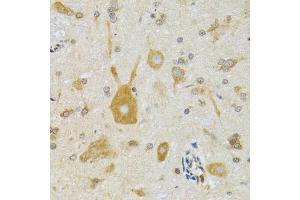 Immunohistochemistry of paraffin-embedded mouse spinal cord using NEU1 antibody (ABIN1980315) at dilution of 1:100 (40x lens). (NEU1 antibody)