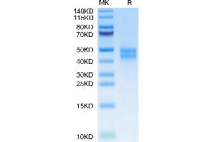 Mouse MXRA8 on Tris-Bis PAGE under reduced condition. (MXRA8 Protein (AA 20-340) (His tag))