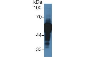 Western Blot; Sample: Human Lung lysate; Primary Ab: 2µg/ml Rabbit Anti-Human aHSG Antibody Second Ab: 0. (Fetuin A antibody  (AA 19-300))