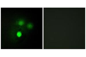 Immunofluorescence analysis of HUVEC cells, using KNTC2 antibody.