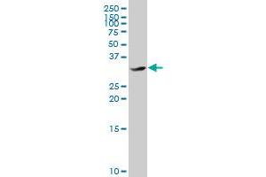 CEBPE polyclonal antibody (A01), Lot # 050921JC01. (CEBPE antibody  (AA 1-281))