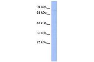 ZNF219 antibody  (C-Term)