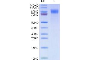 Cynomolgus CD30 on Tris-Bis PAGE under reduced condition. (TNFRSF8 Protein (AA 27-394) (His tag))