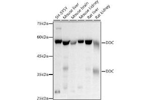Western blot analysis of extracts of various cell lines, using DDC antibody (ABIN1679510, ABIN3018150, ABIN3018151 and ABIN6220384) at 1:500 dilution. (DDC antibody  (AA 1-100))