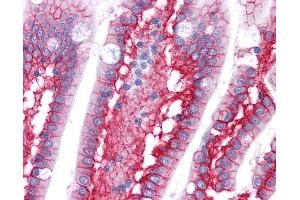 Anti-CTNNB1 / Beta Catenin antibody IHC of human small intestine.