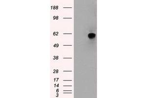 Image no. 2 for anti-Nuclear Receptor Binding Protein 1 (NRBP1) antibody (ABIN1499829) (NRBP1 antibody)