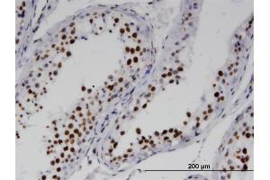 Immunoperoxidase of monoclonal antibody to RNF25 on formalin-fixed paraffin-embedded human testis. (RNF25 antibody  (AA 352-459))