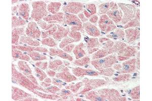 Anti-TADA3 / ADA3 antibody IHC staining of human heart. (TADA3L antibody  (C-Term))