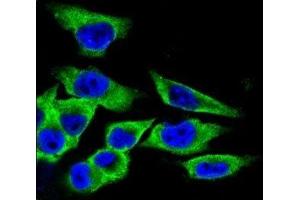 Confocal immunofluorescent analysis of LDHA antibody with A375 cells followed by Alexa Fluor 488-conjugated goat anti-rabbit lgG (green). (Lactate Dehydrogenase A antibody  (AA 204-232))