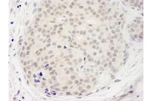 Immunohistochemistry (IHC) image for anti-DEAD (Asp-Glu-Ala-Asp) Box Polypeptide 23 (DDX23) (AA 1-50) antibody (ABIN7448517)