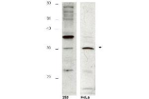 Western blot using  affinity purified anti-Hus1B antibody shows detection of a 36kDa band corresponding to Hus1B in a HeLa cell lysate (arrowhead). (HUS1B antibody  (AA 104-117))