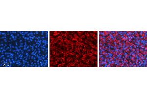 Rabbit Anti-TAPBP Antibody   Formalin Fixed Paraffin Embedded Tissue: Human Liver Tissue Observed Staining: Cytoplasm in hepatocytes Primary Antibody Concentration: 1:100 Other Working Concentrations: N/A Secondary Antibody: Donkey anti-Rabbit-Cy3 Secondary Antibody Concentration: 1:200 Magnification: 20X Exposure Time: 0. (TAPBP antibody  (N-Term))