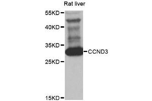 Western blot analysis of extracts of rat liver, using CCND3 antibody (ABIN5970442) at 1/1000 dilution. (Cyclin D3 antibody)