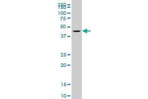 DEAF1 monoclonal antibody (M06), clone 3E6 Western Blot analysis of DEAF1 expression in SW-13 . (DEAF1 antibody  (AA 133-222))