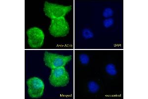 ABIN185357 Immunofluorescence analysis of paraformaldehyde fixed U2OS cells, permeabilized with 0. (Acetylcholinesterase antibody  (C-Term))