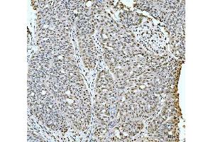 IHC analysis of 53BP1/TP53BP1 using anti-53BP1/TP53BP1 antibody (ABIN7599869).
