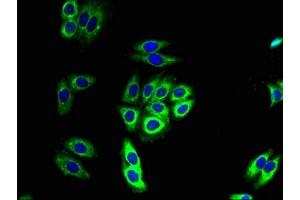Immunofluorescent analysis of HepG2 cells using ABIN7160916 at dilution of 1:100 and Alexa Fluor 488-congugated AffiniPure Goat Anti-Rabbit IgG(H+L) (NDUFB11 antibody  (AA 30-88))