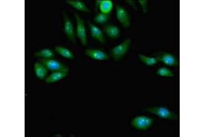Immunofluorescent analysis of A549 cells using ABIN7163798 at dilution of 1:100 and Alexa Fluor 488-congugated AffiniPure Goat Anti-Rabbit IgG(H+L)