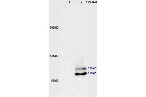 Lane 1: human colon carcinoma lysates Lane 2: mouse brain lysates probed with Anti phospho-PI3 Kinase p110 beta(Ser1070) Polyclonal Antibody, Unconjugated (ABIN872304) at 1:200 in 4 °C. (PIK3CB antibody  (pSer1070))