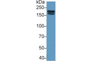 Detection of PZP in Rat Serum using Polyclonal Antibody to Pregnancy Zone Protein (PZP) (PZP antibody  (AA 1251-1500))
