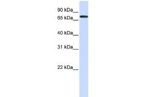 WB Suggested Anti-GALNT6 Antibody Titration:  0.
