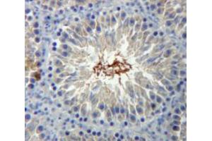 Used in DAB staining on fromalin fixed paraffin-embedded Testis tissue (BRCA2 antibody  (AA 2913-3151))
