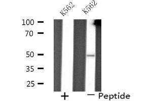 Western blot analysis of extracts from K562 cells using PP4R2 antibody. (PPP4R2 antibody  (Internal Region))