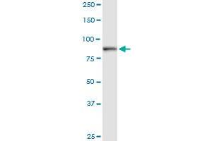 DCAMKL1 monoclonal antibody (M01), clone 7D10. (DCLK1 antibody  (AA 640-729))