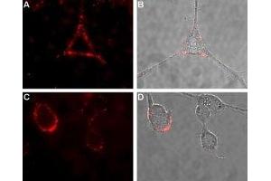 Expression of CALCR in rat PC12 cells - Cell surface detection of CALCR in intact living rat pheochromocytoma (PC12) cells. (Calcitonin Receptor antibody  (1st Extracellular Loop))