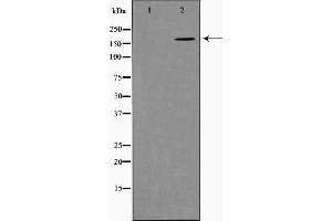 Western blot analysis on K562 cell lysate using Collagen XIalpha 1 Antibody，The lane on the left is treated with the antigen-specific peptide. (COL11A1 antibody  (Internal Region))
