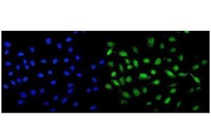 IF analysis of MCAK using anti-MCAK antibody (ABIN3043278). (KIF2C antibody  (AA 531-725))