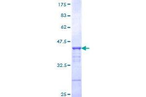 CHD3 Protein (AA 1654-1741) (GST tag)