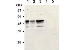 Western Blotting (WB) image for anti-Cyclin E1 (CCNE1) antibody (ABIN567783)